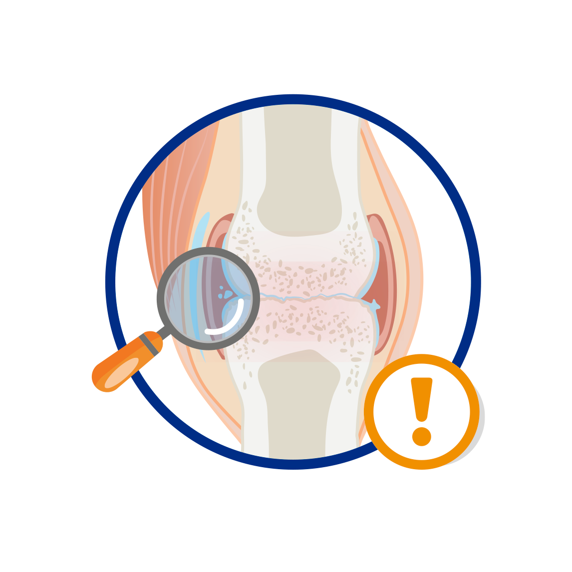 carticureplus_cuida_articulaciones